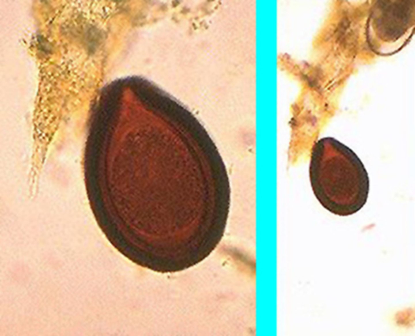 <p>Large animal coccidia</p>