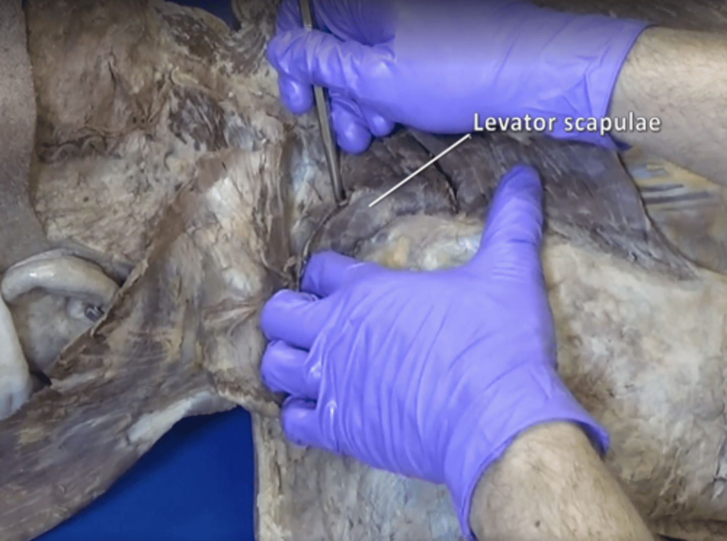 <p>elevates the medial margin of the scapula</p>