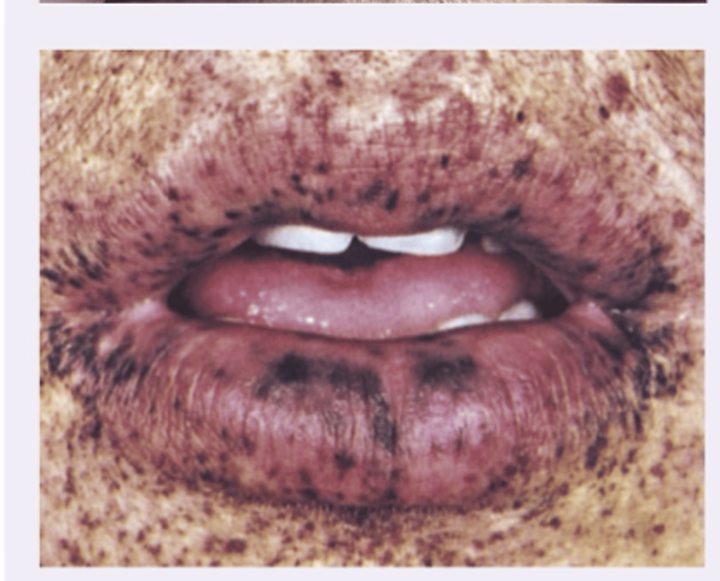 <p>Diagnosis?</p>