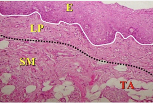 <p>Mucosa oral (3 capas)</p>
