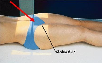 <p>PP: Supine; ASISs equidistant from table; knee flexed slightly; IR center at level of greater trochanters</p><p>RP: level of ASISs</p><p>CR: 40o caudad</p><p>SS: Pelvic ring/inlet</p>