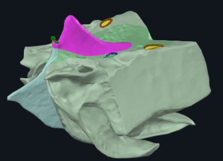 term image