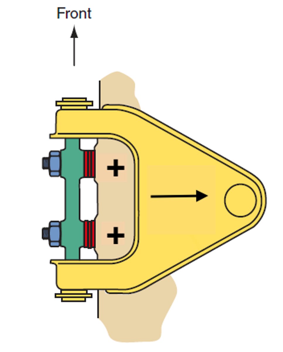 <p>How would adding/subtracting shims as performed in the picture effect the alignment (Note the location of the front of the vehicle)</p>
