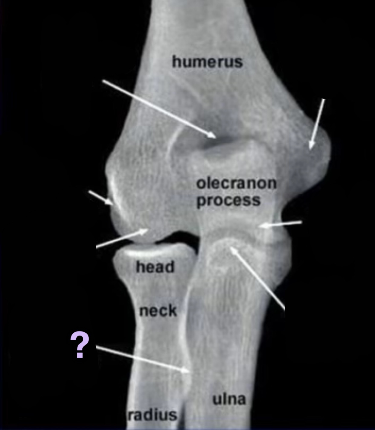 term image