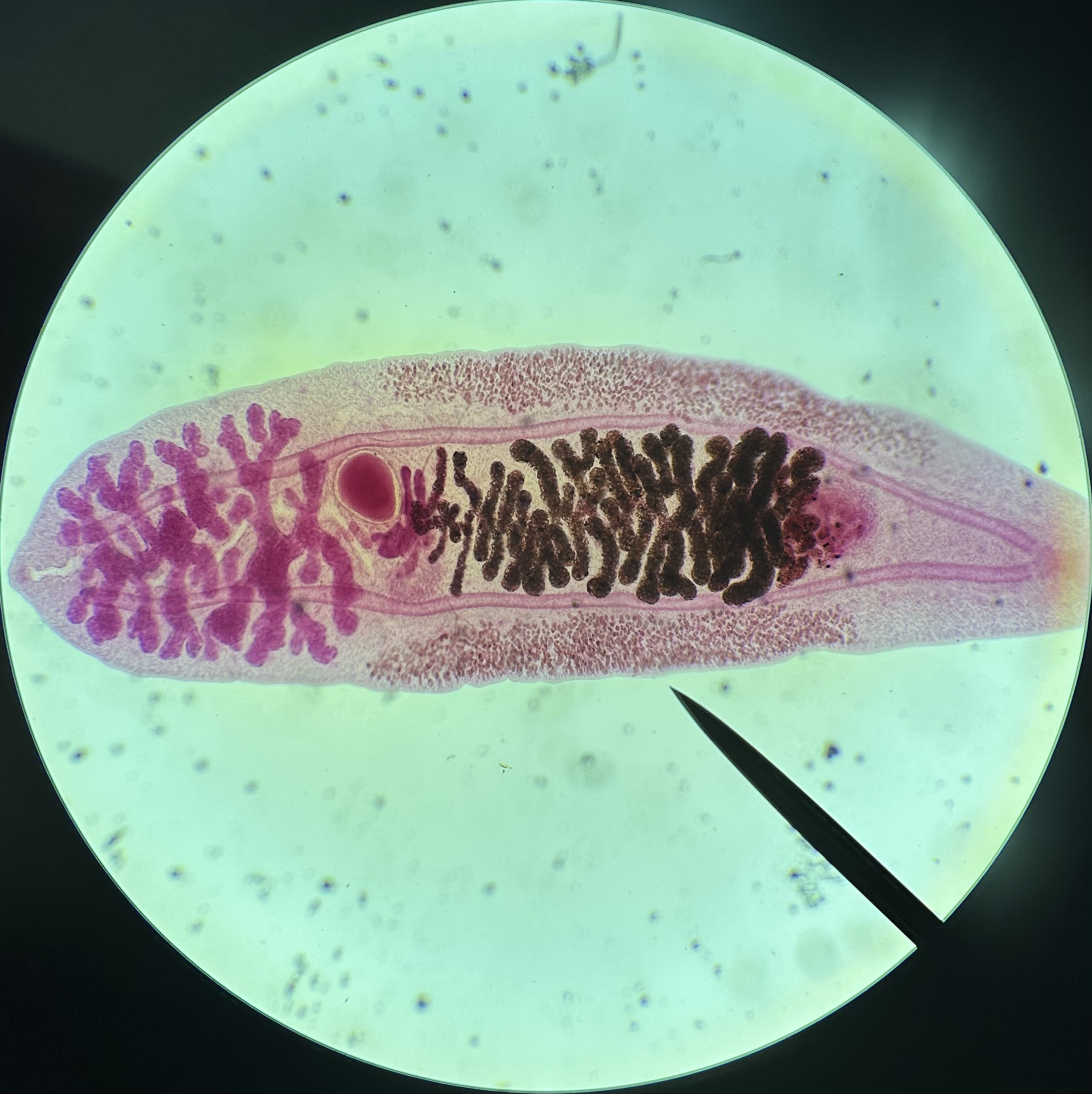 <p>Identify the organism and the Class it belongs to</p>