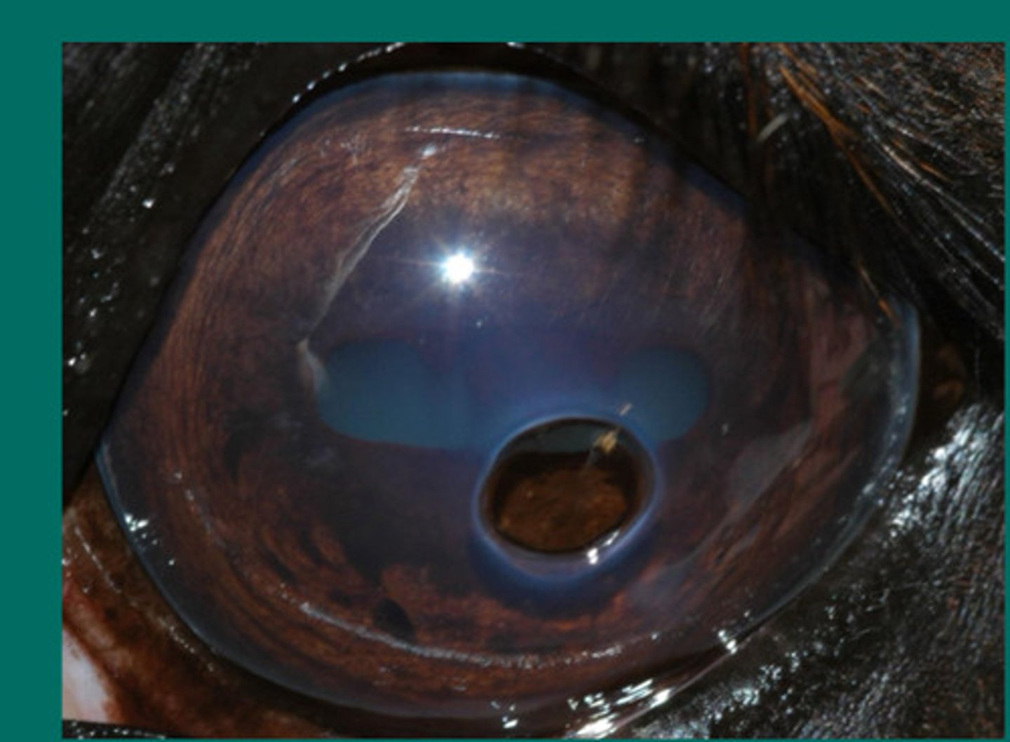 <p>Describe this eye issue and what it implies is going to happen next to this eye if untreated?</p>