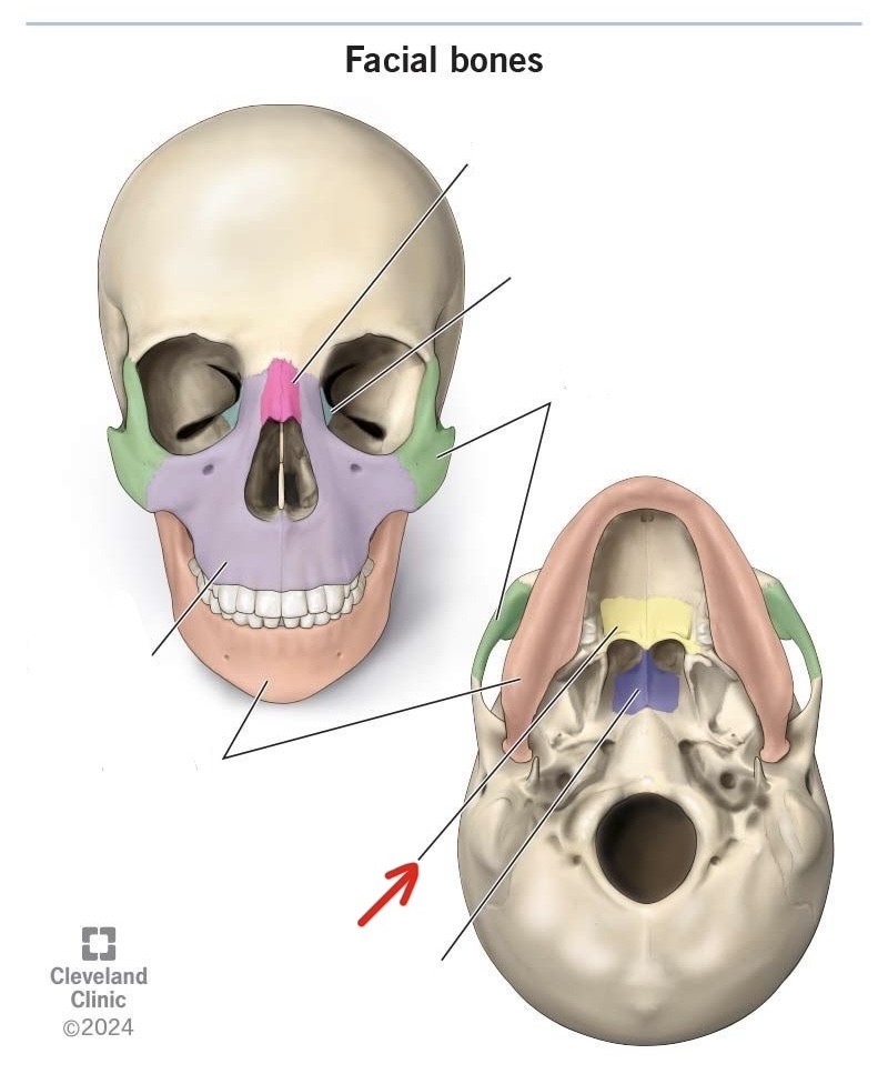 term image