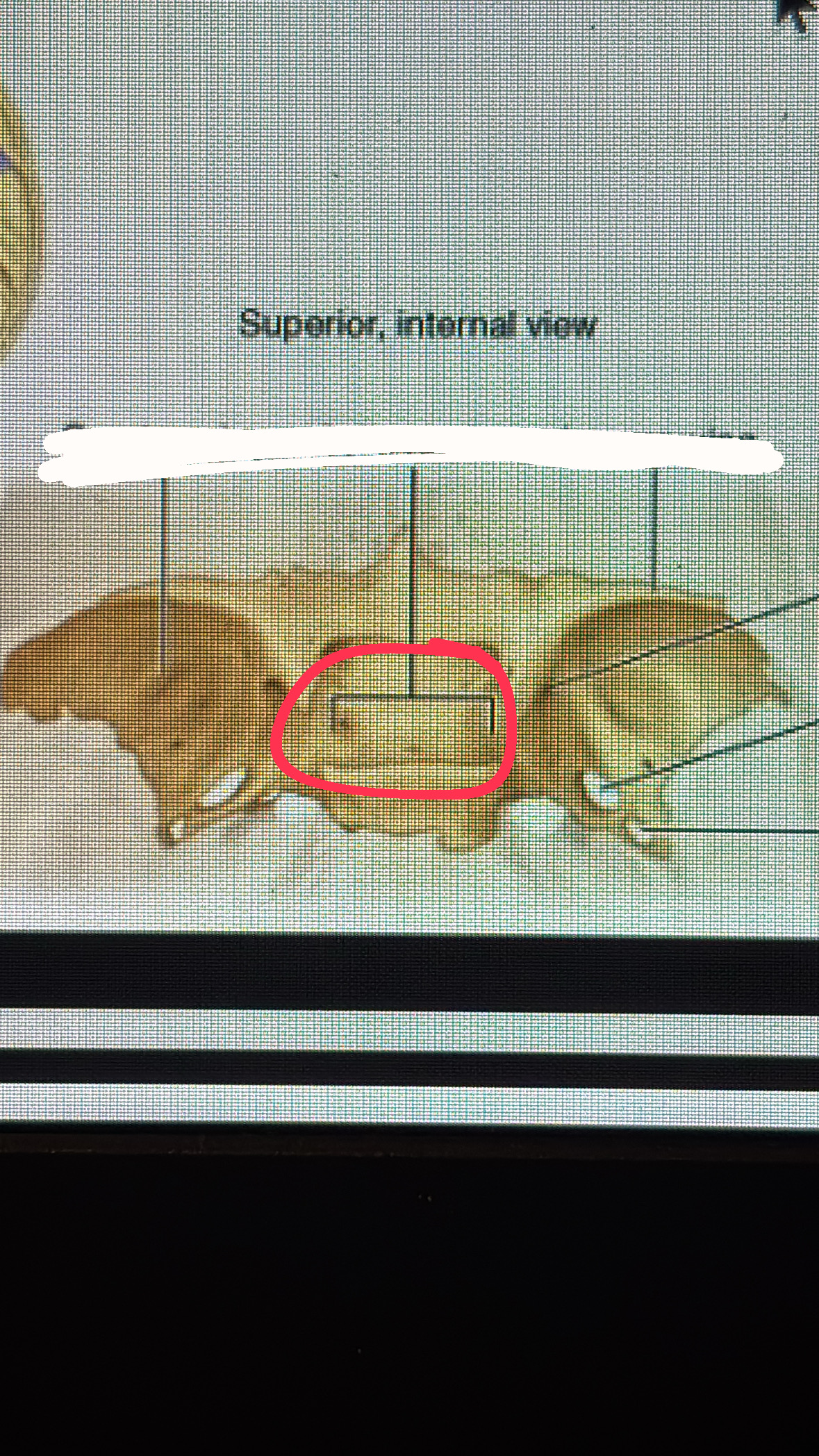 <p>superior middle part of the bad heading towards the back of head</p>