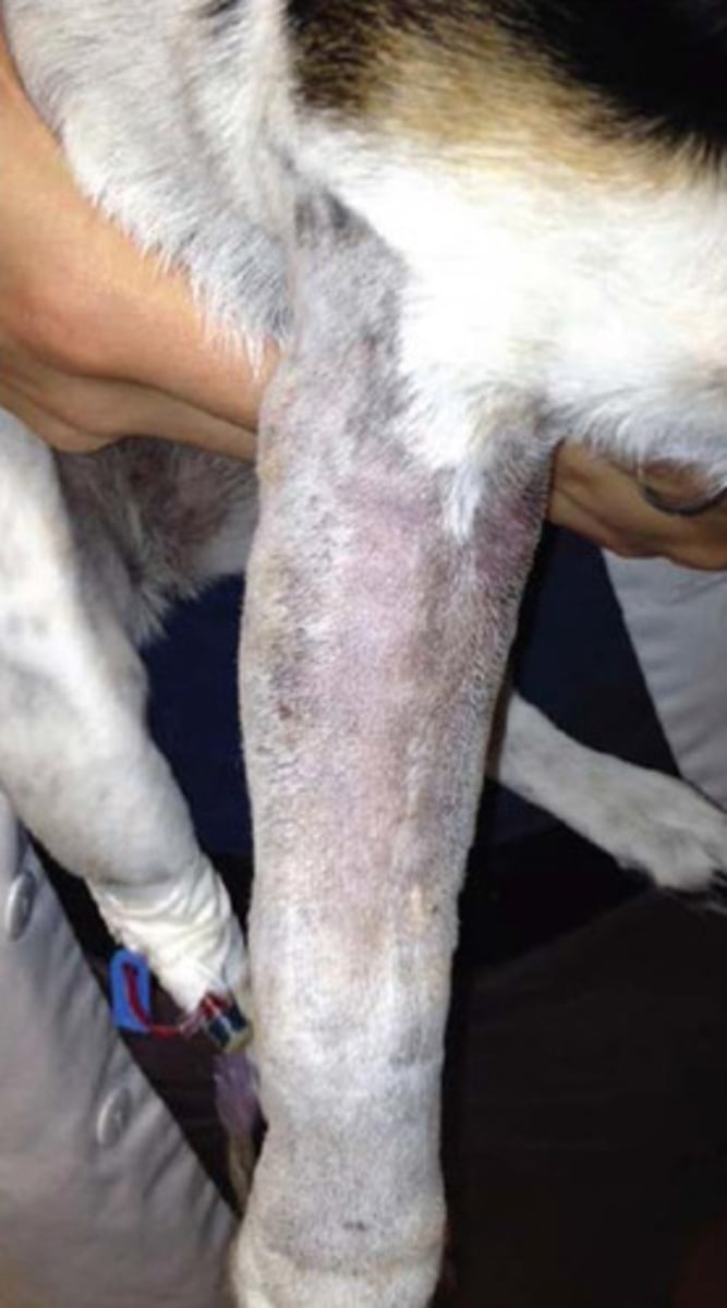 <p>What is compartment syndrome?</p><p>Why does it occur?</p><p>How can you fix it?</p>