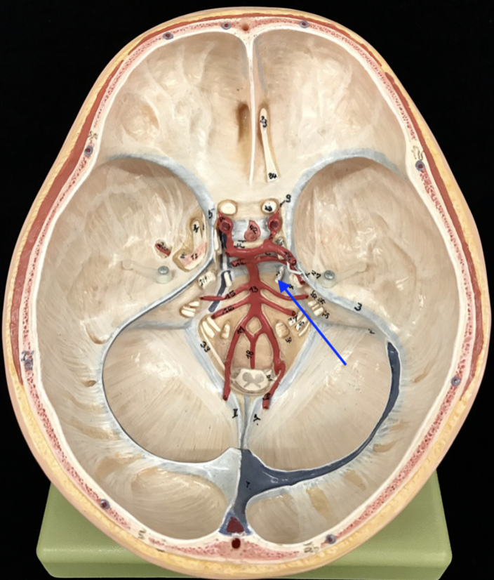 <p>What is the cranial nerve and roman numeral?</p>