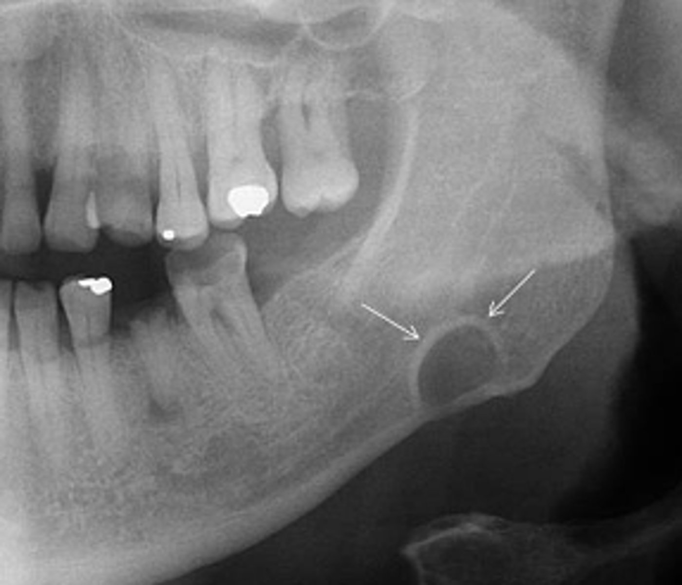 <p>ID the pathology:</p>