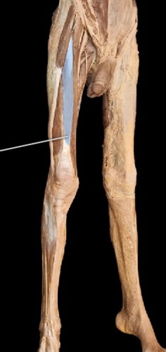 <p>What muscle is this?</p>