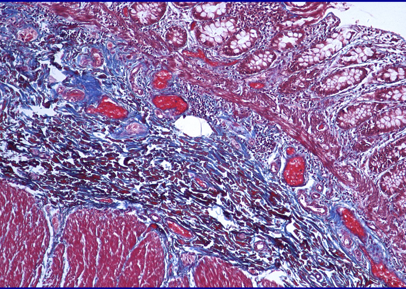 <p>ID the stain type </p>