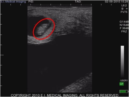 <p>What is the red circle pointing to?</p>