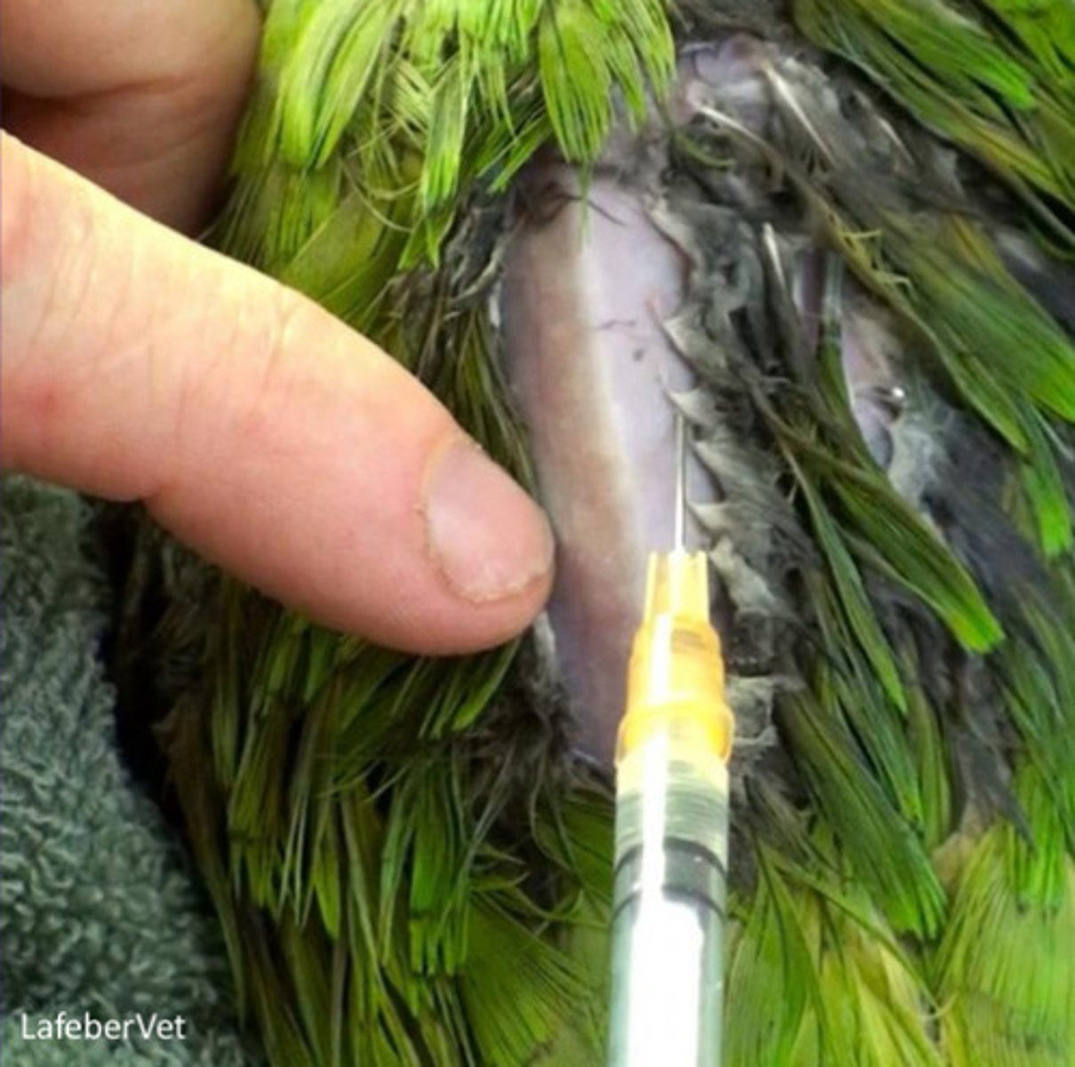 <p>Where give IM injections?</p>