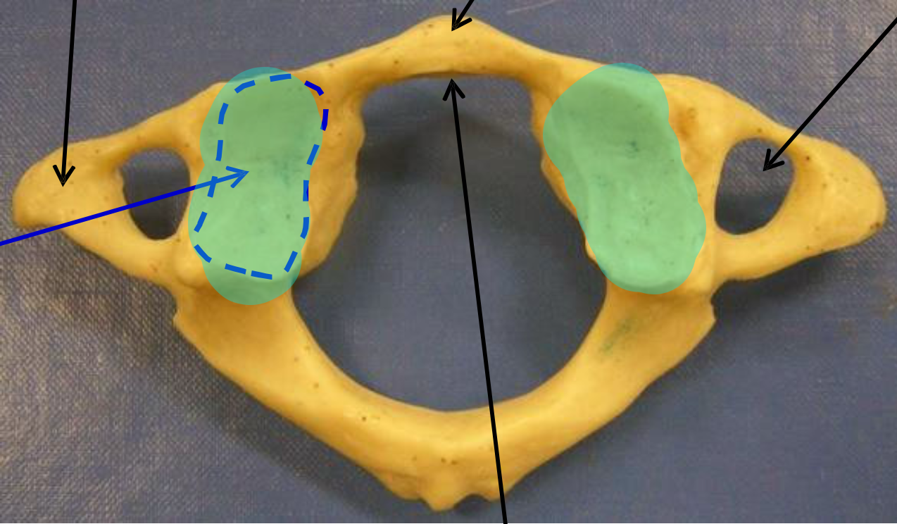 <p>Name the highlighted structure.</p>