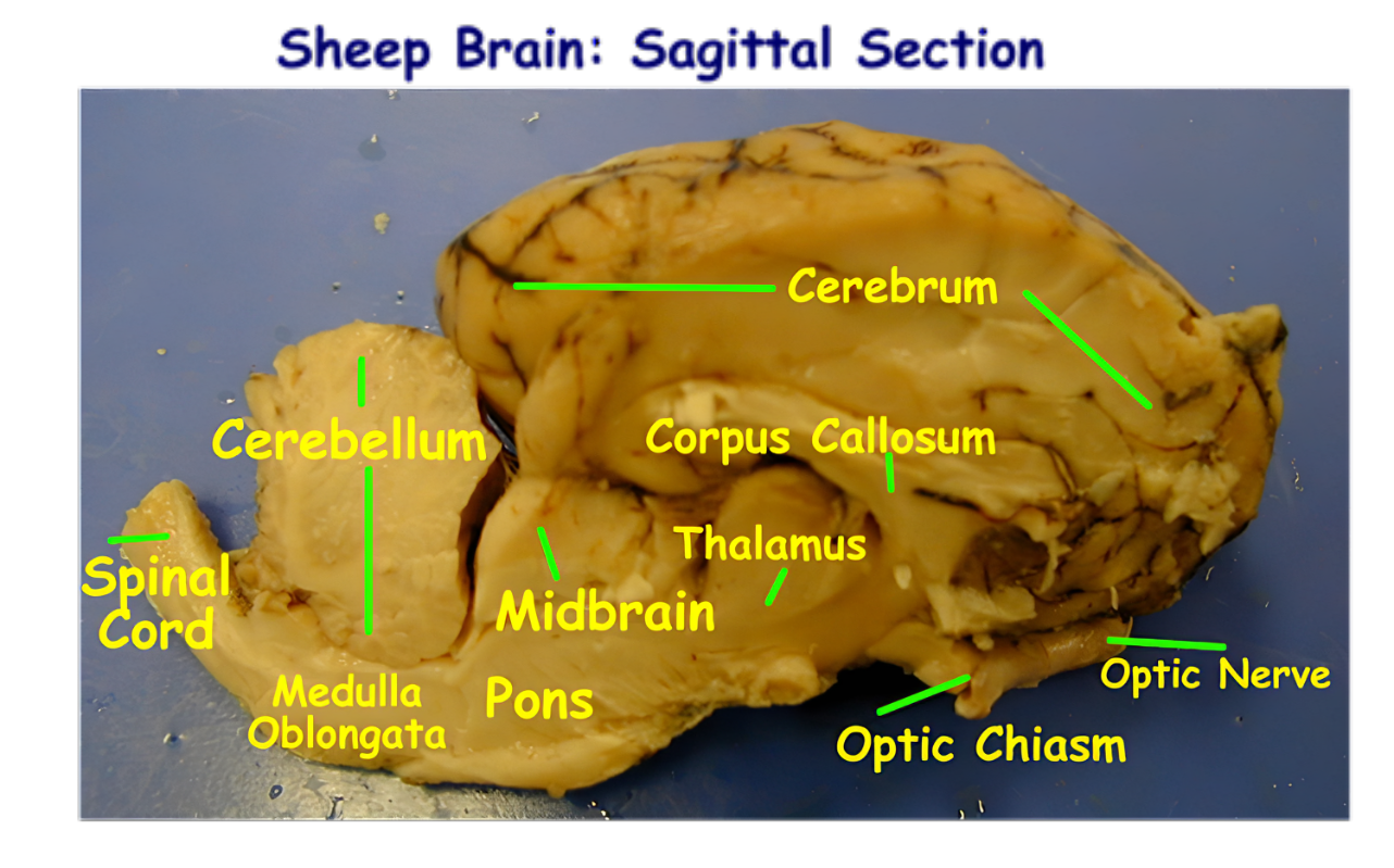 <p>Between the Cerebrum and Thalamus</p>