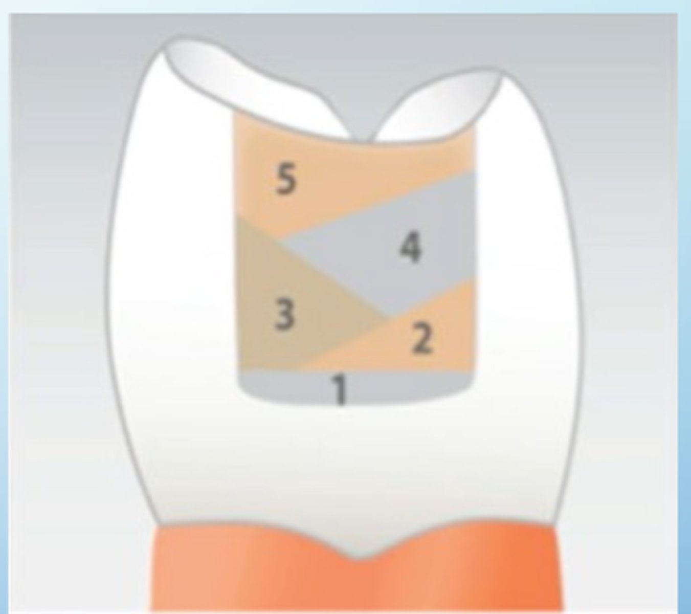 <p>Increment should touch one wall and slope towards the other but NOT TOUCH the other wall.</p>