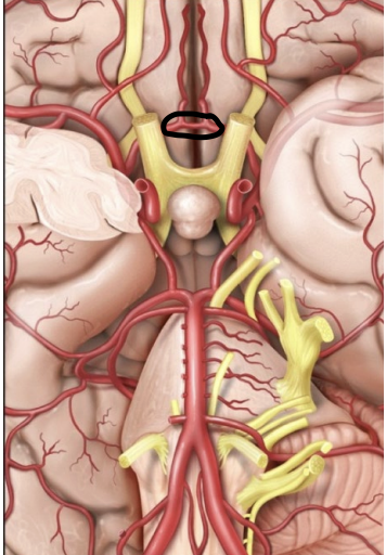 <p>A vessel that connects both anterior cerebral arteries as part of the cerebral arterial circle.</p>