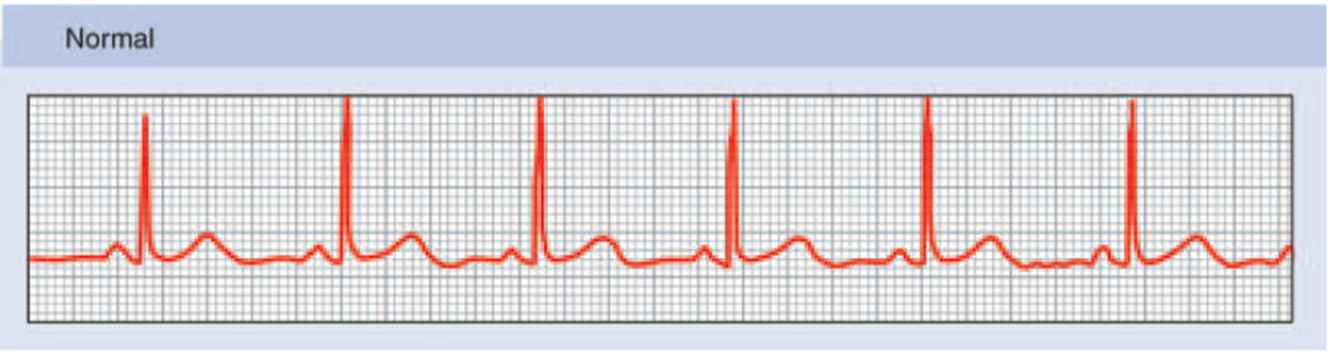 <p><span style="font-family: Calibri">Record of the electrical activity  of the heart</span></p>