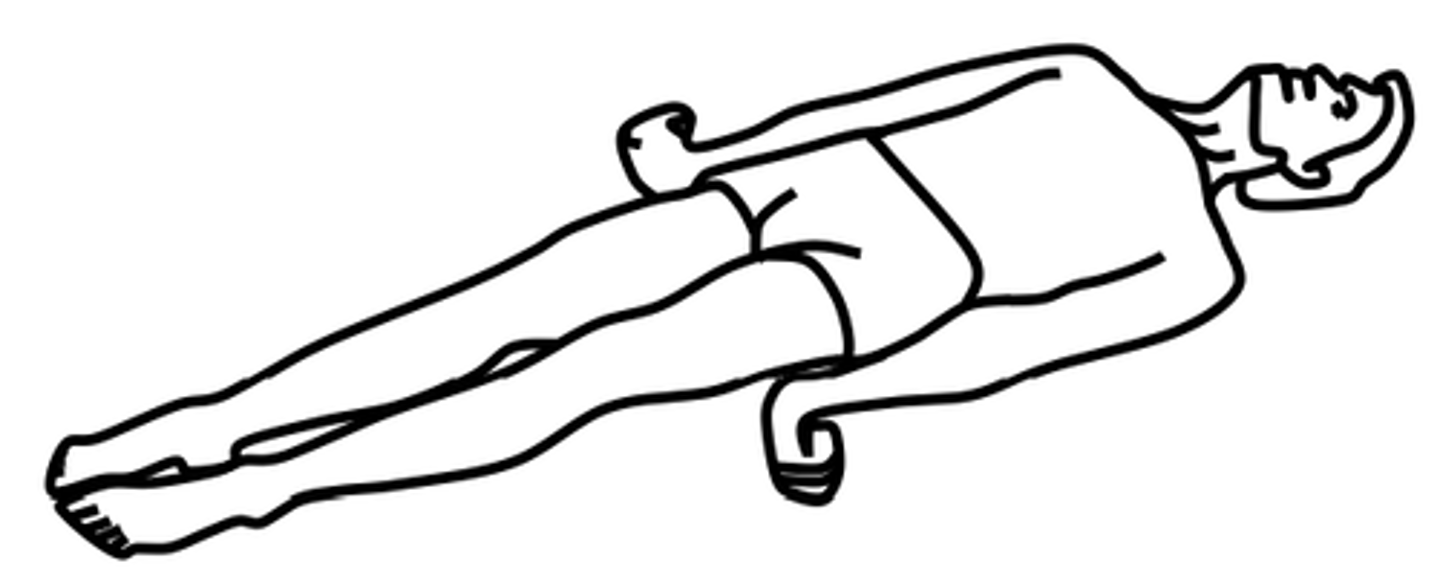 <p>position of an unconscious person where the upper extremities and lower extremities are extended and the wrists are flexed</p>