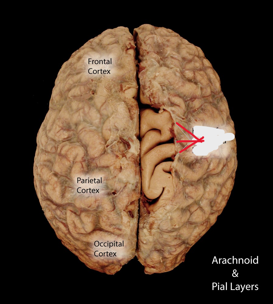 <p>covering. webby like covering</p>