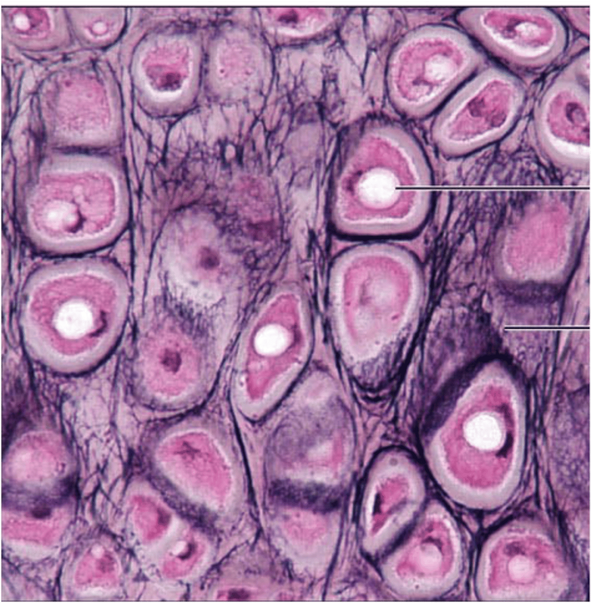 <p>- similar to hyaline but contains more elastic fibres</p>