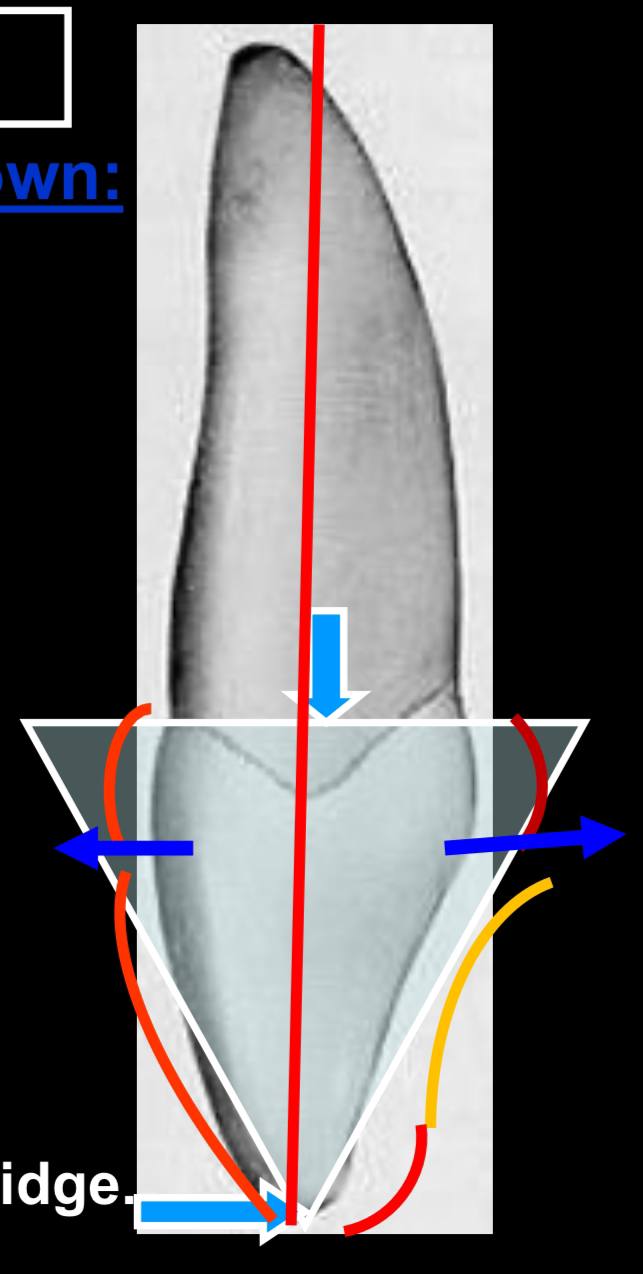 <p>the mesial cervicale line is convex where?</p>