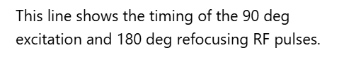 <p>A. Radiofrequency (RF)</p>