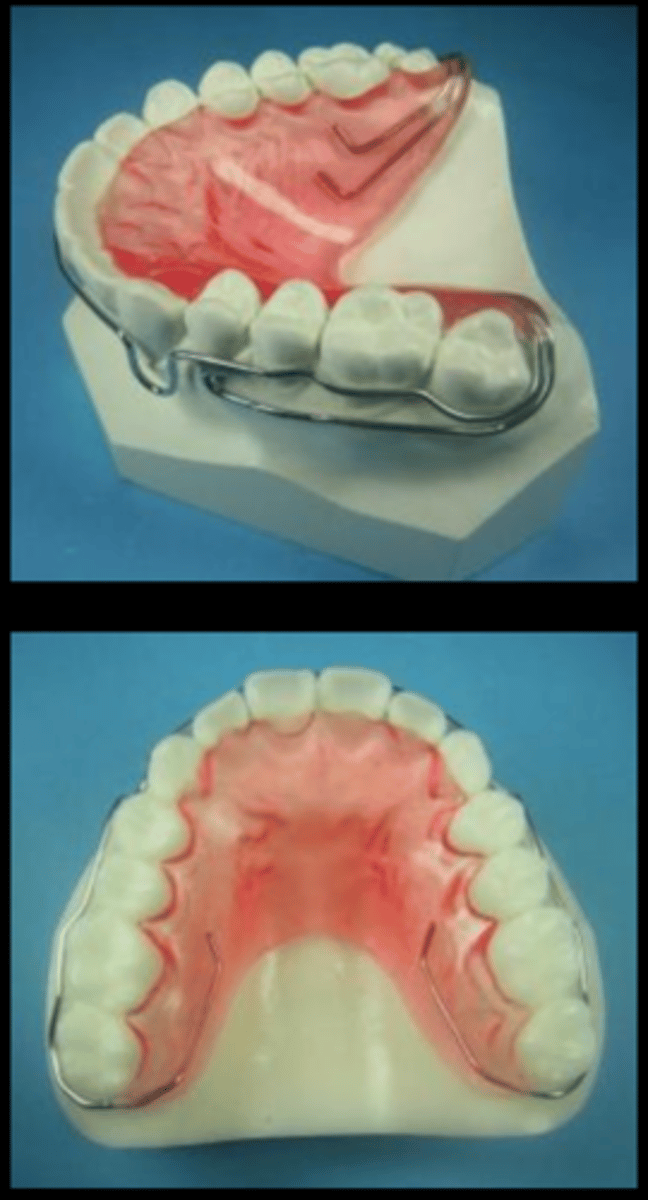 <p>Dr. Tremont made this !</p><p>stabilizes the labial bow</p>