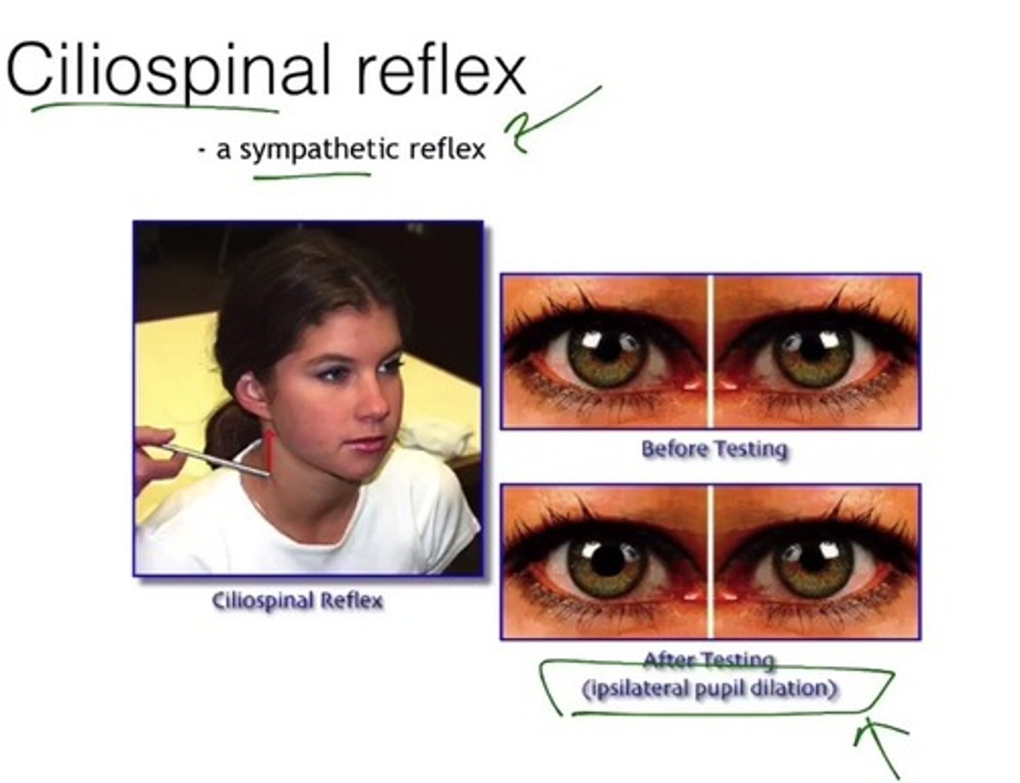<p>Stimulation (almost painful) of the back of the neck causes ipsilateral (same side) pupil dilation.</p>