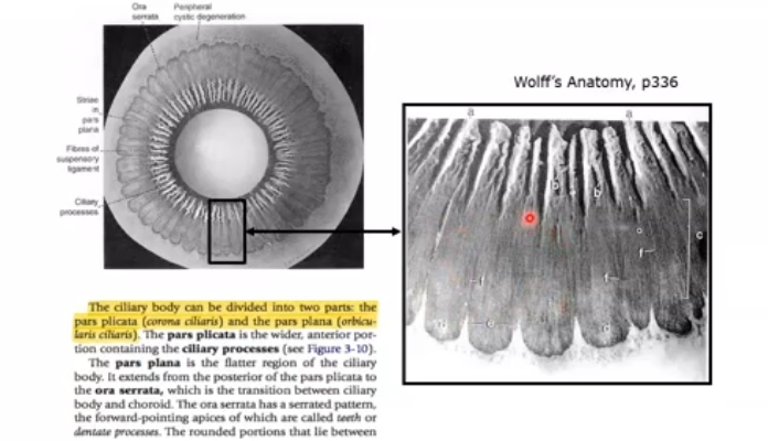<p>posterior view of ciliary body </p>