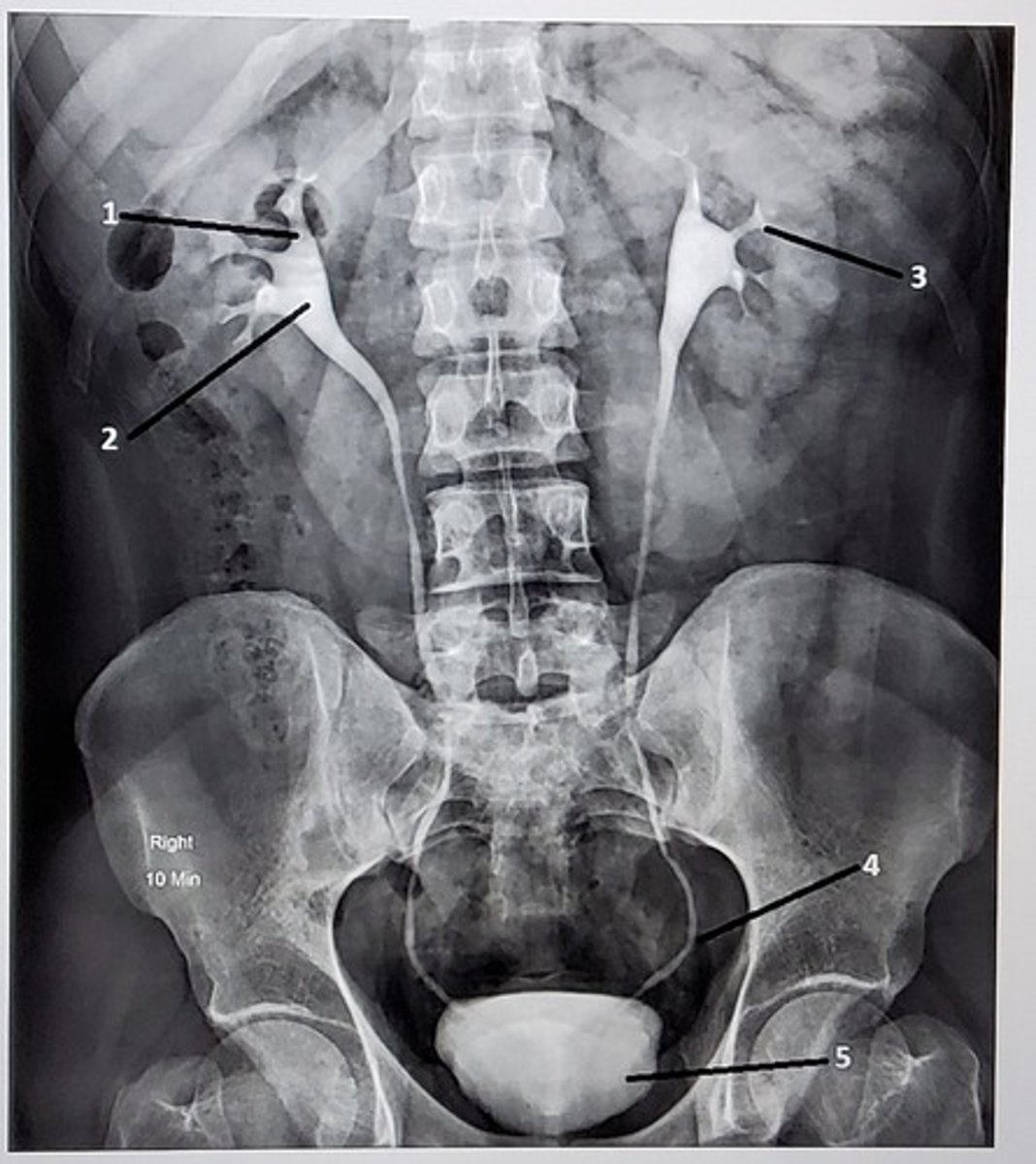 <p>Identify the anatomic structures labeled on this image. Your label should be descriptive (proximal/distal, which side of the body, etc).</p>