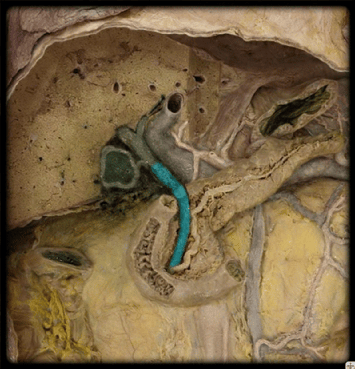 <p>Identify this structure leading into the duodenum.</p>