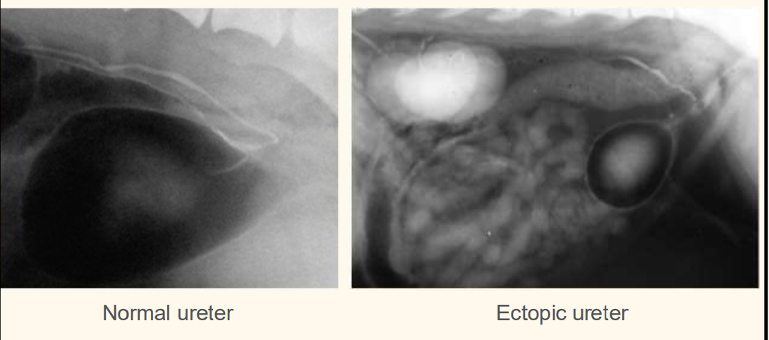 <p>air -ve contrast</p>