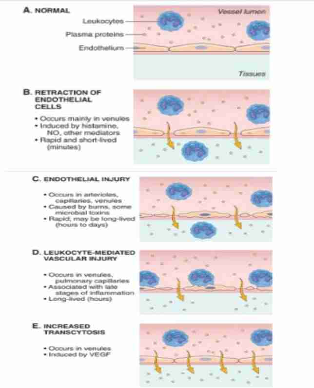 <ul><li><p>Leading to escape of protein-rich exudate into extravascular tissue, causing edema</p></li></ul><p>Mechanism</p><ul><li><p>Contraction of endothelial cells resulting in increased interendothelial spaces</p></li><li><p>Endothelial injury, resulting in endothelial cell necrosis and detachment</p></li><li><p>Leukocytes meditate vascular injury</p></li><li><p>Increased transport of fluid and proteins, called transcytosis, through endothelial cell</p></li></ul>