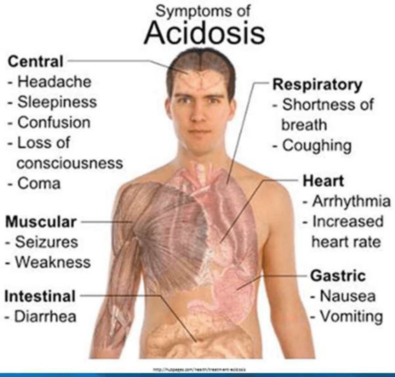 <p>Deep, labored breathing pattern associated with severe metabolic acidosis.</p>