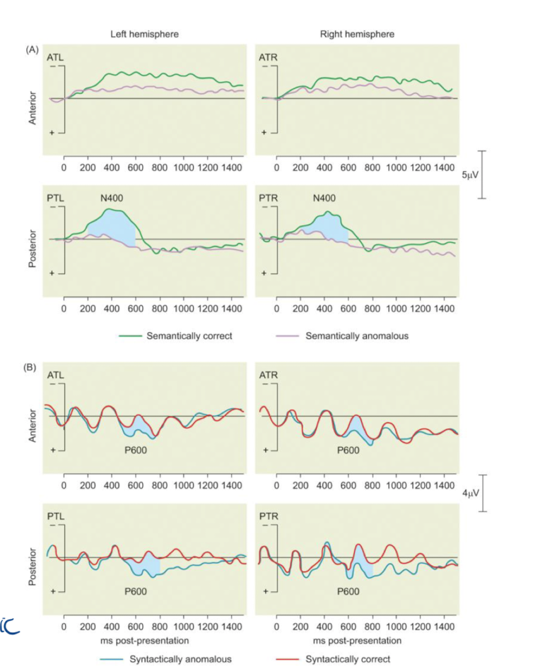 <p>a P600 (positivity) difference to syntactic violations (grammar)</p><p>ex: child throw pig.</p>