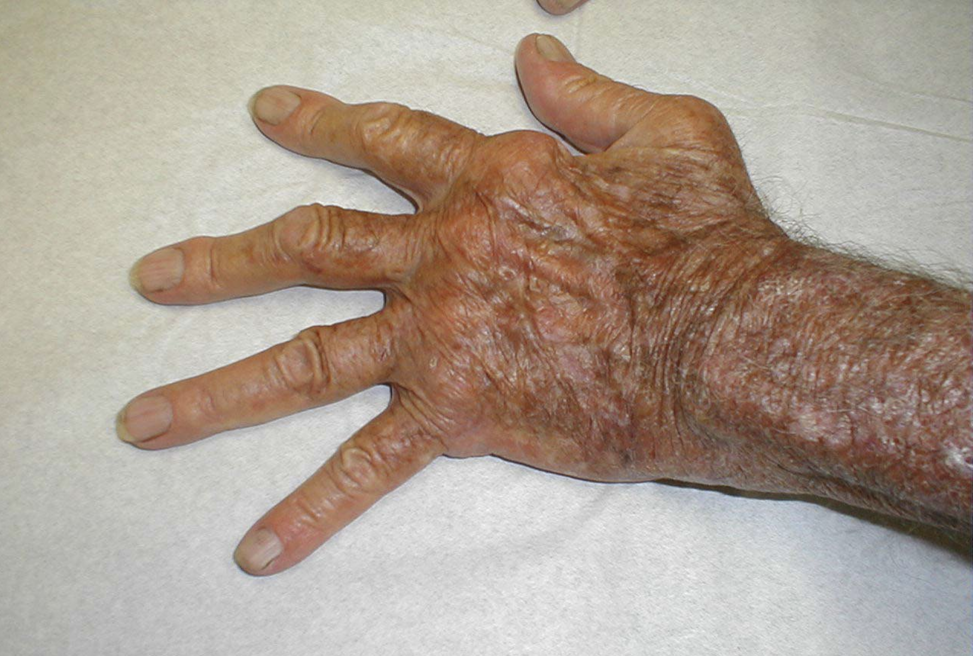 <p>What condition is this</p>