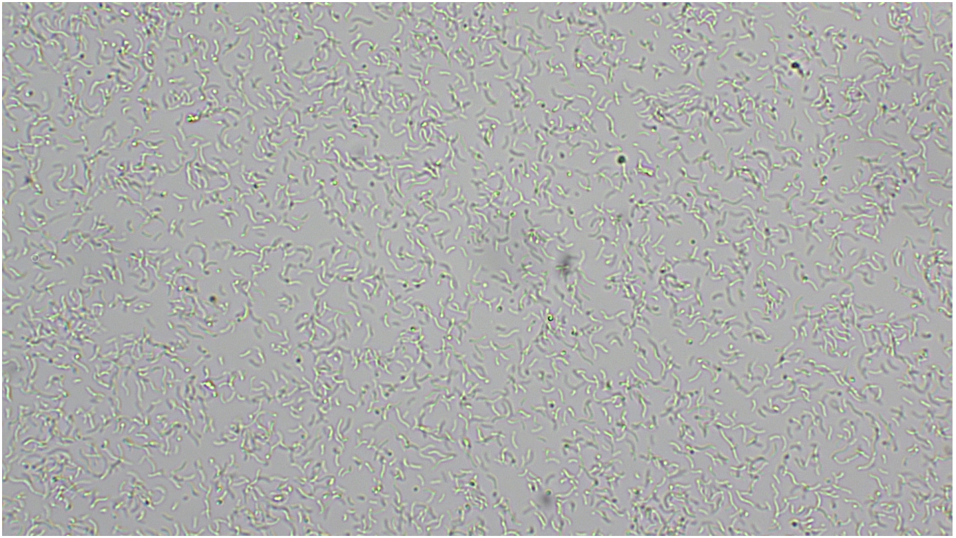 <p>purple, non-sulfur bacteria, bacteriochlorophyll captures light energy, photosynthesize without producing oxygen. Colorless in high oxygen levels and purple-red when oxygen levels are low.</p><p>Doman: Bacteria</p><p>Shape: spirillum</p><p>Movement: Motile-flagellum</p><p>Metabolic features: photoautotroph (can also perform fermentation)</p>