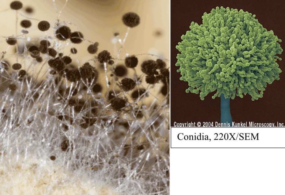 <p>Genus: Aspergillus</p>