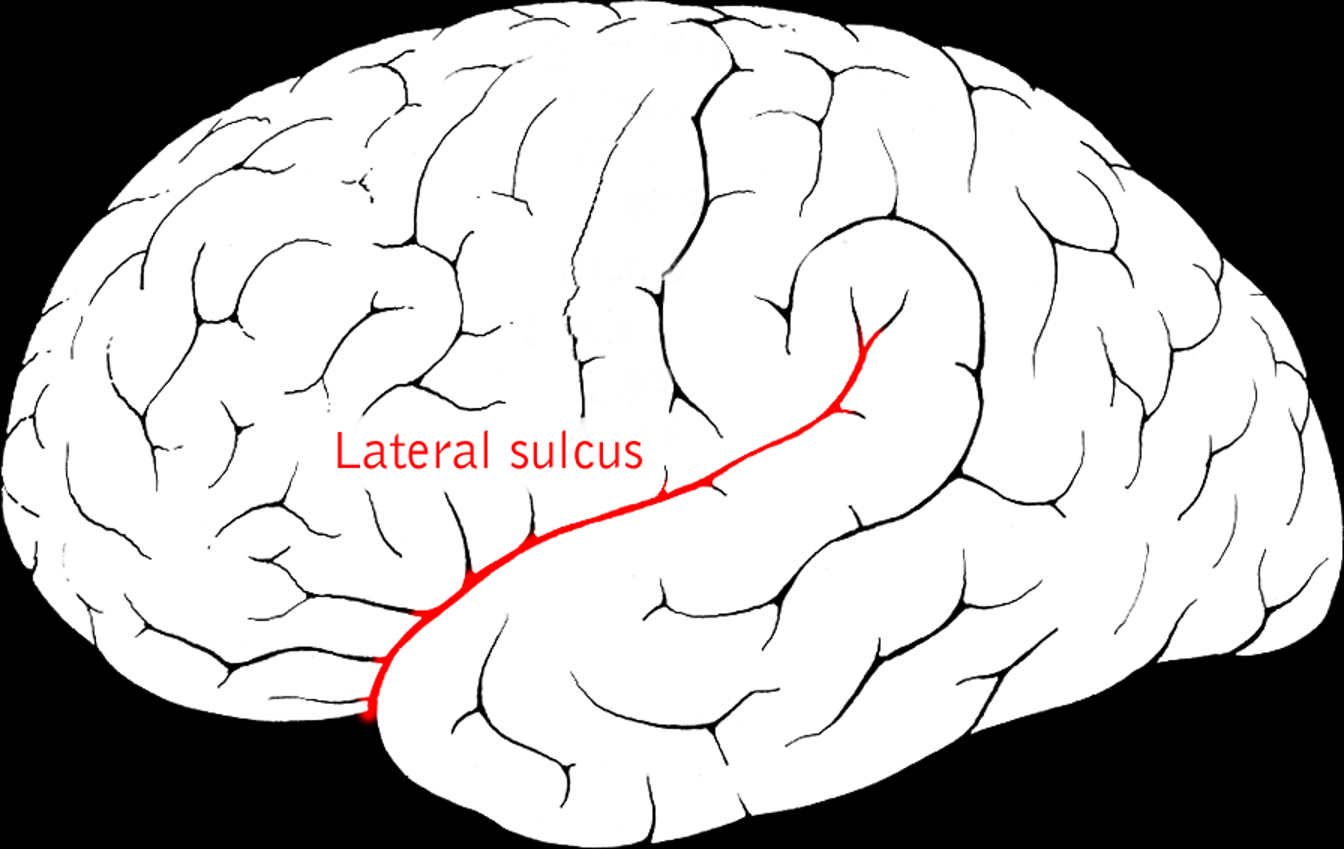 <p>Separates temporal lobe from parietal and frontal lobes</p>