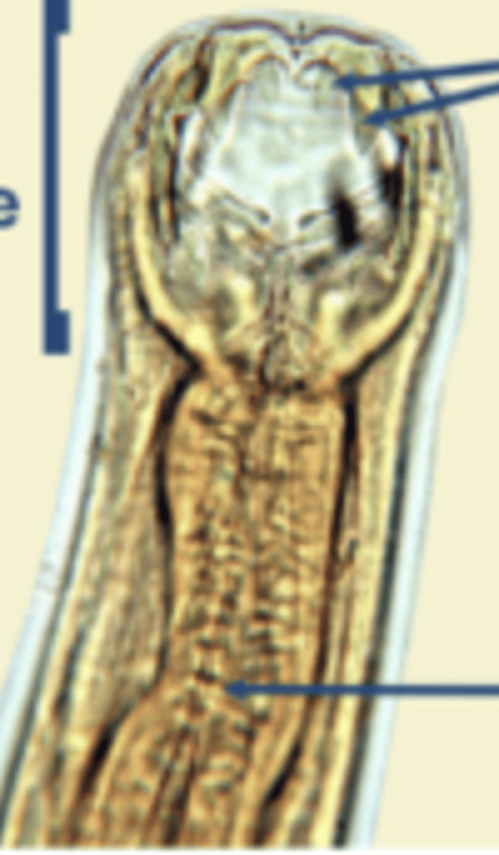 <p>Isolated in a dog with severe anaemia and weight loss. What parasite is this?</p>