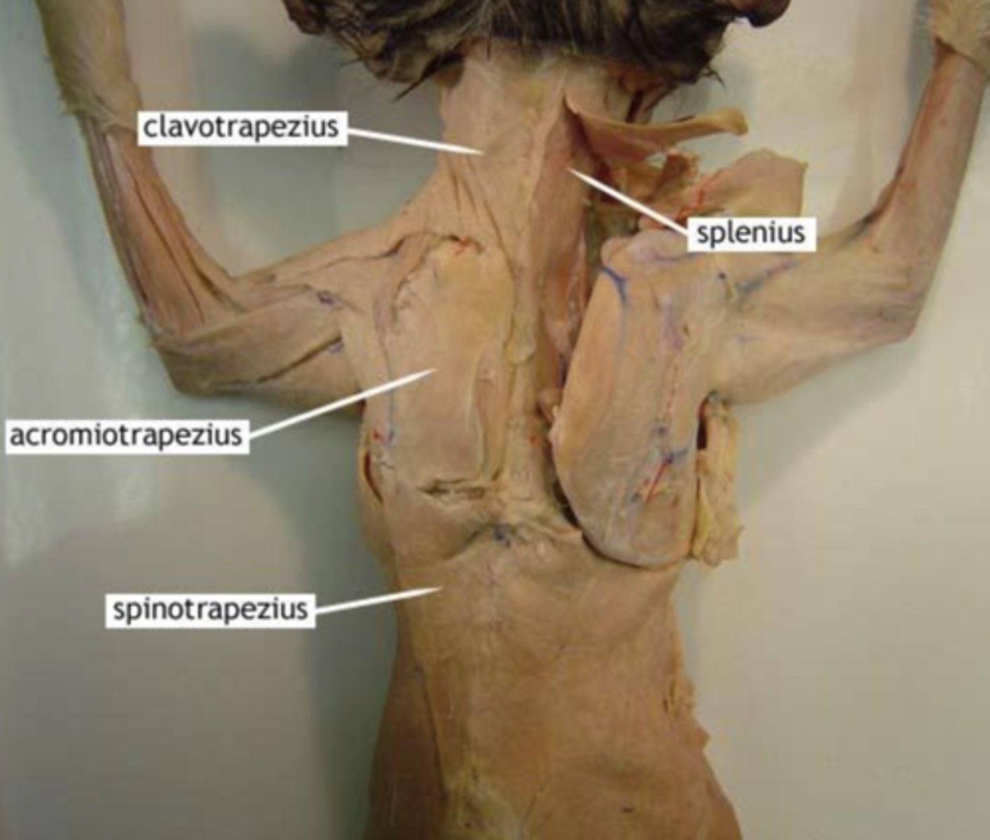 <p>occipital bone of skull and spines of cervical vertebrae</p>