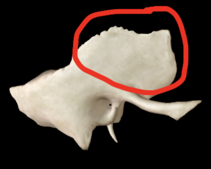 <p>What part of the temporal bone is this?</p>