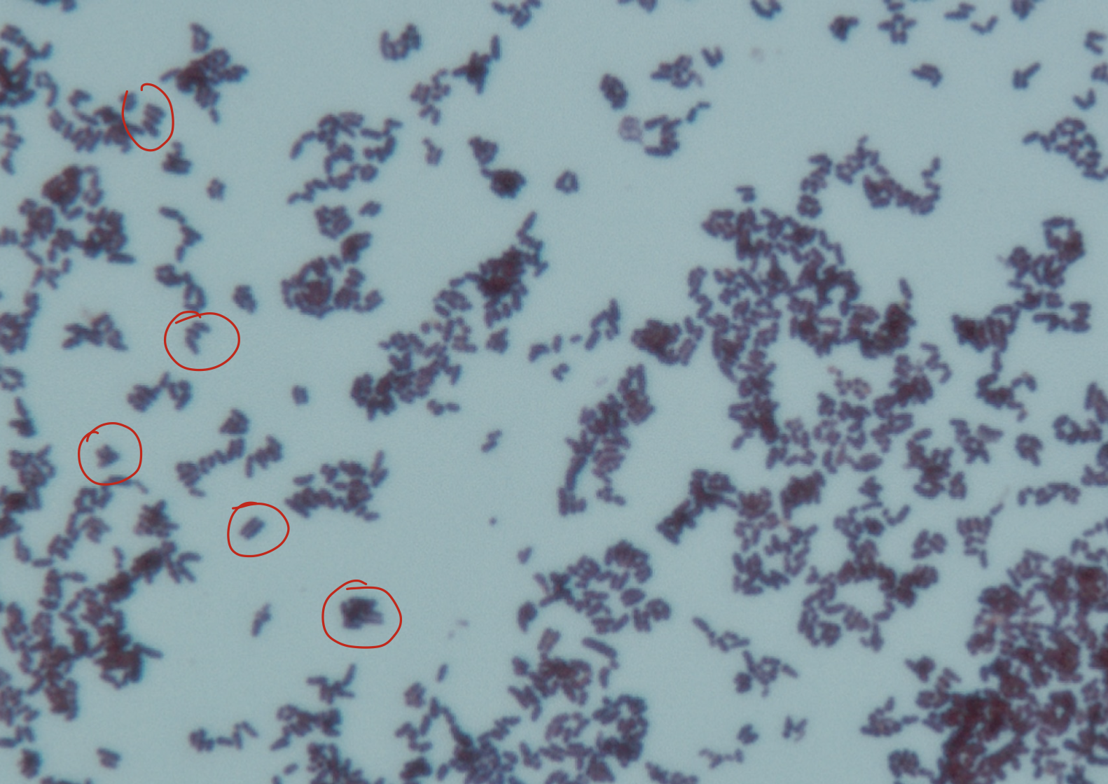 <p>Coryneform or diphteroid bacteria morphology</p>