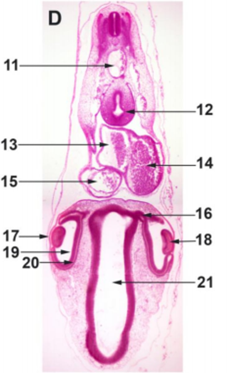 <p>#20 ectoderm</p>
