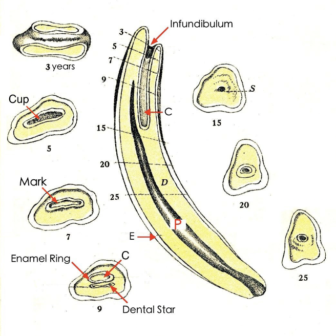 <p>D - Makes up most of tooth, bone like material under enamel</p>
