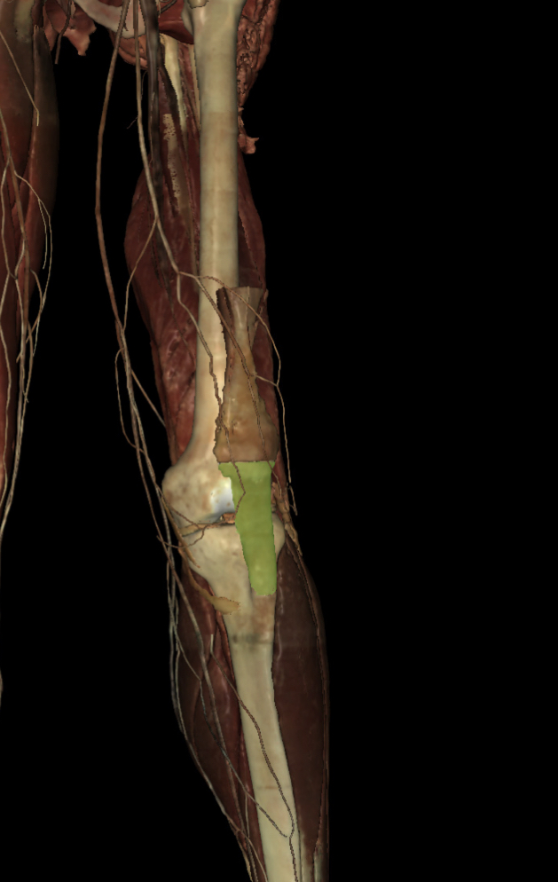 <p>Identify the Structure</p>