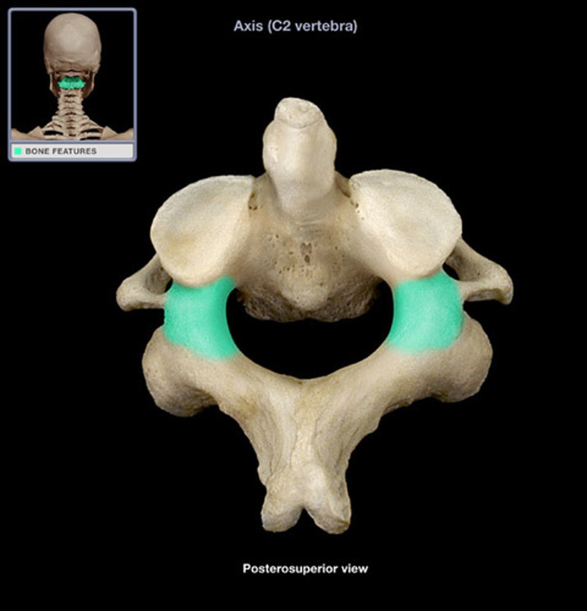 <p>(what vertebra and what structure is highlighted)</p>